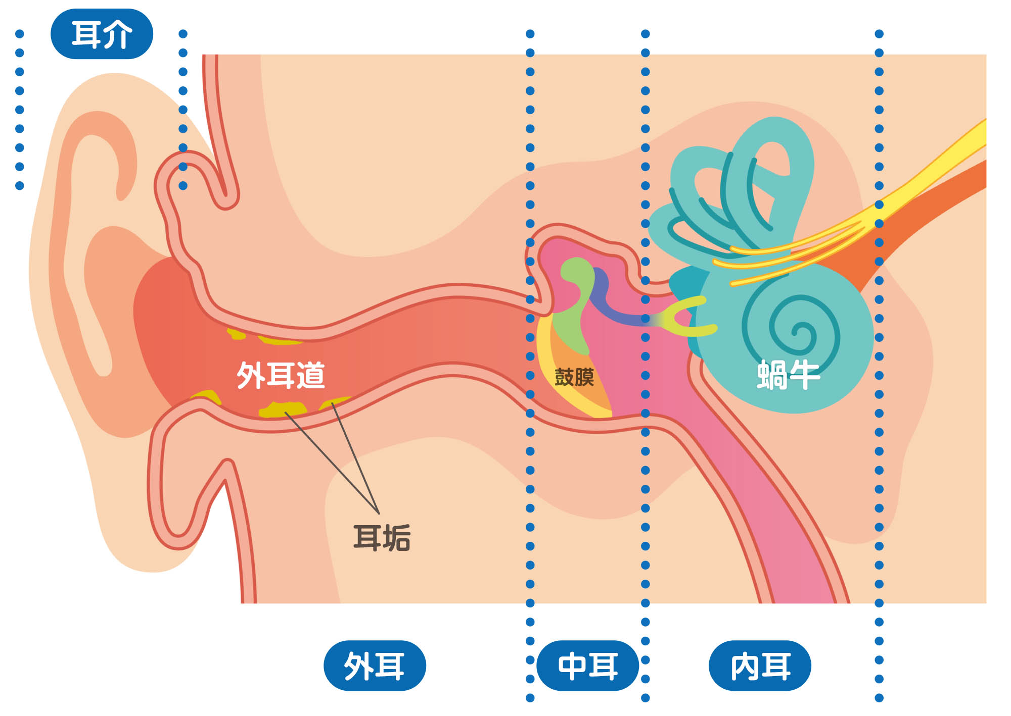 耳垢 しっとり