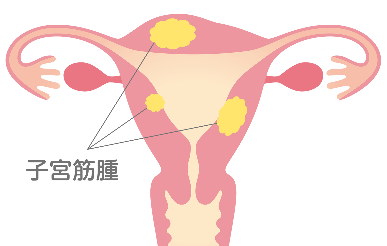 ちくちく 子宮