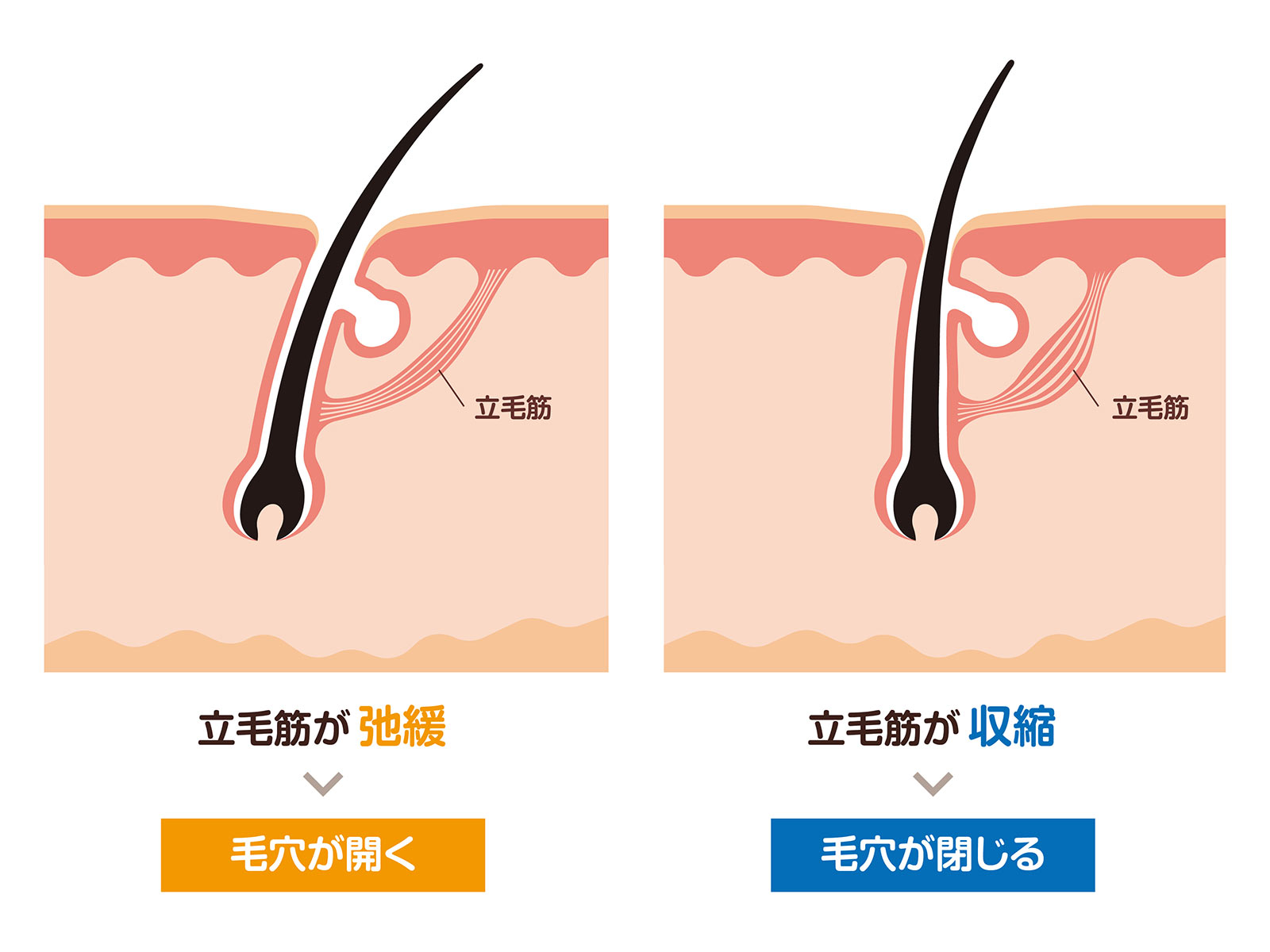 毛穴が目立つ人の原因はコレ！